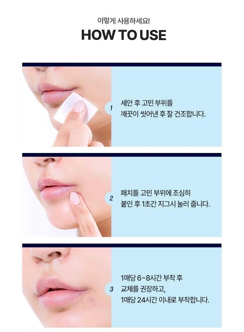 Olive Young 人氣隱形暗瘡貼🏆 |102+30貼裝