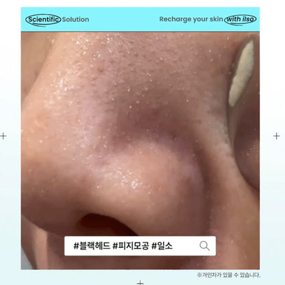 ilso 150ml+150ml 黑頭粉刺導出液🥚