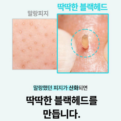 ilso 150ml+150ml 黑頭粉刺導出液🥚